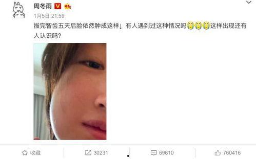爆料谭竹吃瓜是真的吗,真相揭秘还是网络谣言？